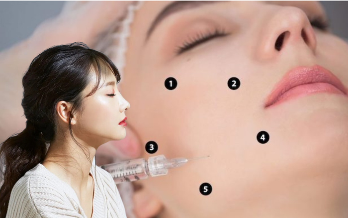 Tiêm BAP trẻ hóa da Phòng khám Da liễu Dr Lê Hiệu