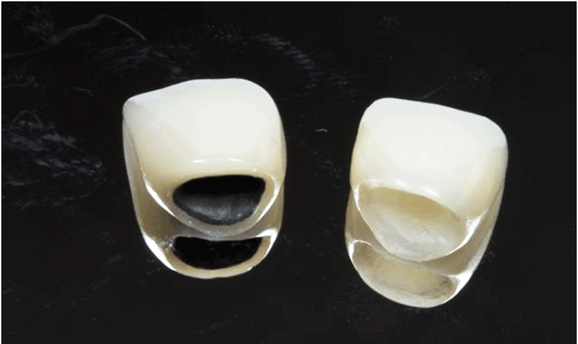 Răng sứ Titan Phòng khám Nha khoa Dr Lê Hiệu