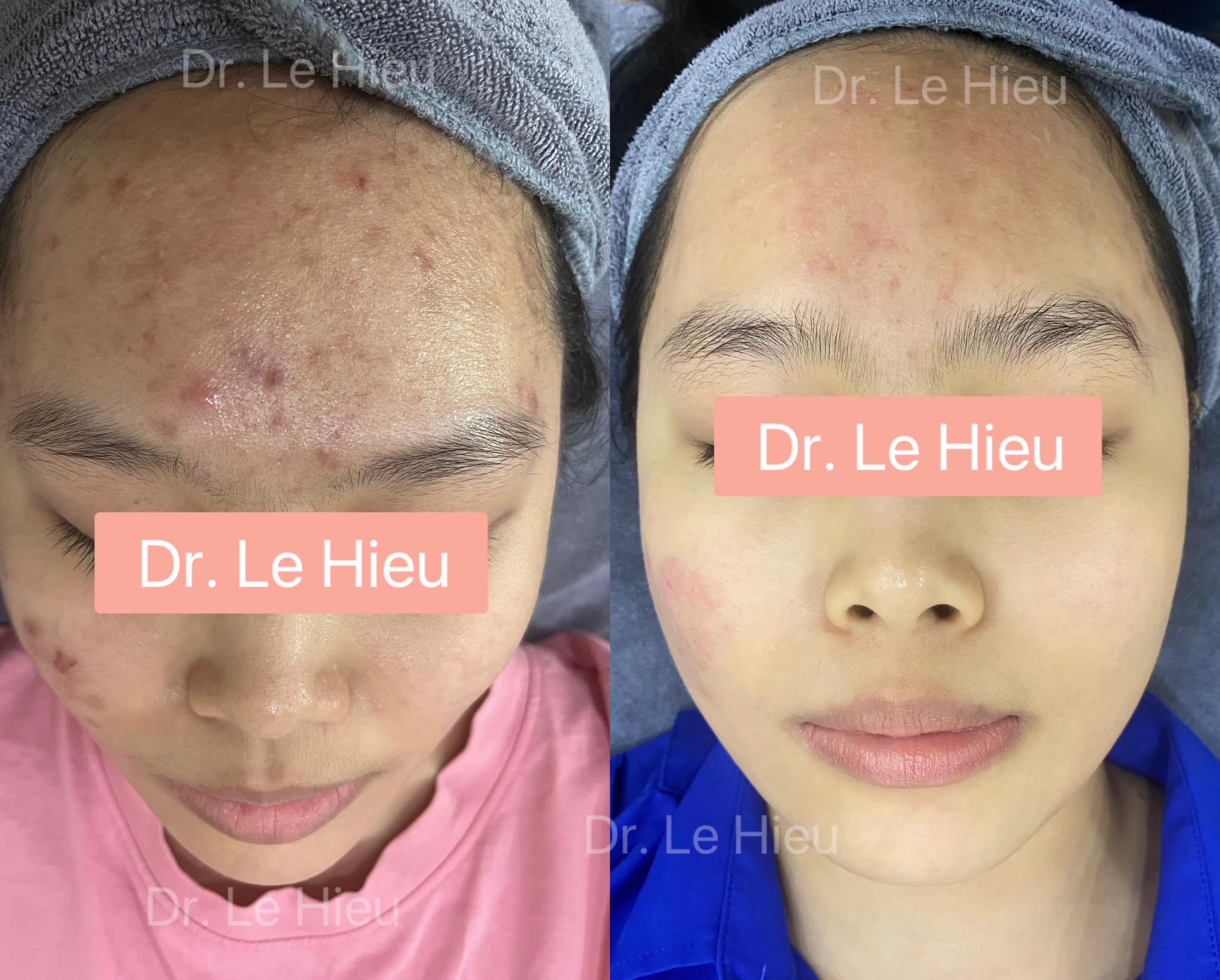 Vì sao nên điều trị da tại Phòng khám da liễu? Phòng khám da liễu Dr Lê Hiệu Bình Dương