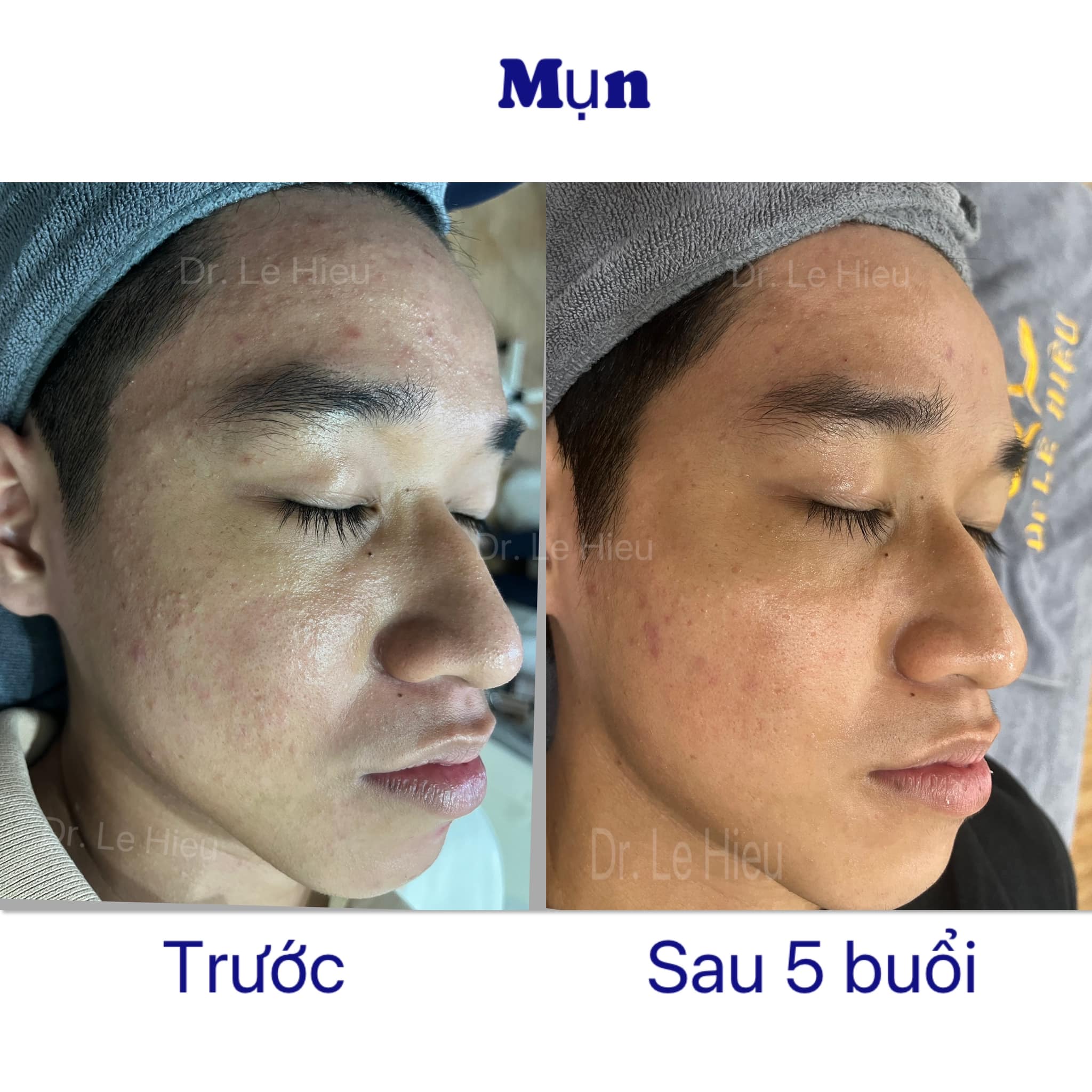 Vì sao nên điều trị da tại Phòng khám da liễu? Phòng khám da liễu Dr Lê Hiệu Bình Dương