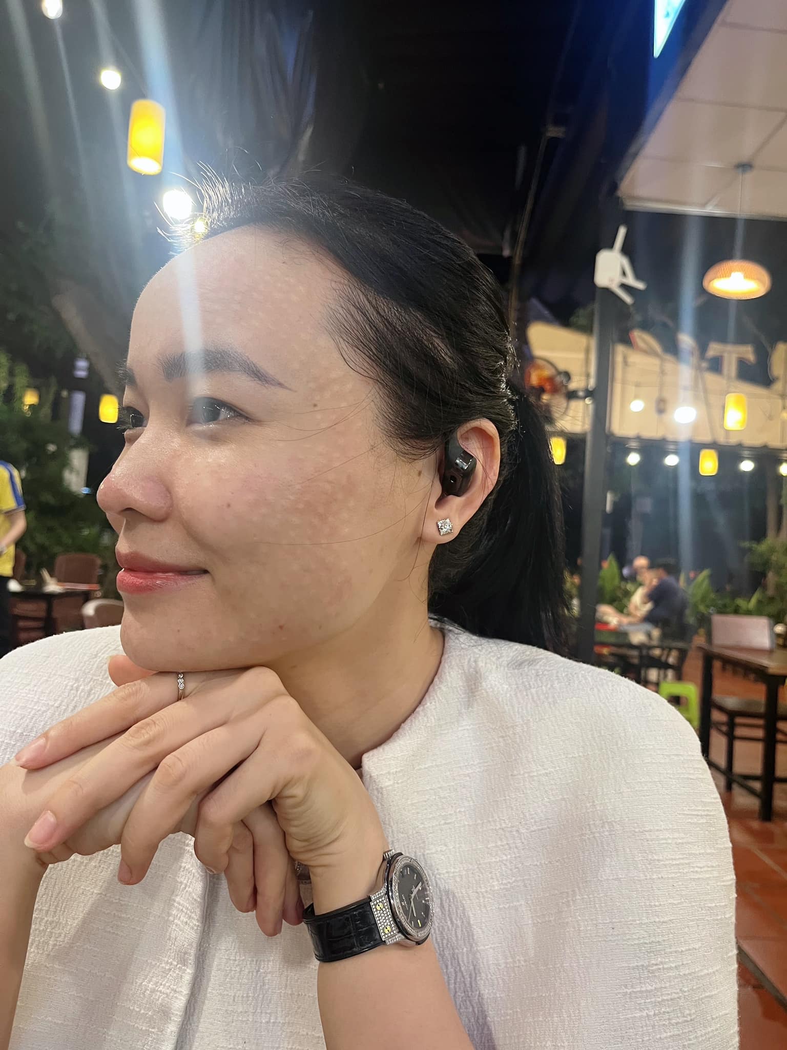 Địa chỉ tiêm Meso trẻ hóa da uy tín Bình Dương
