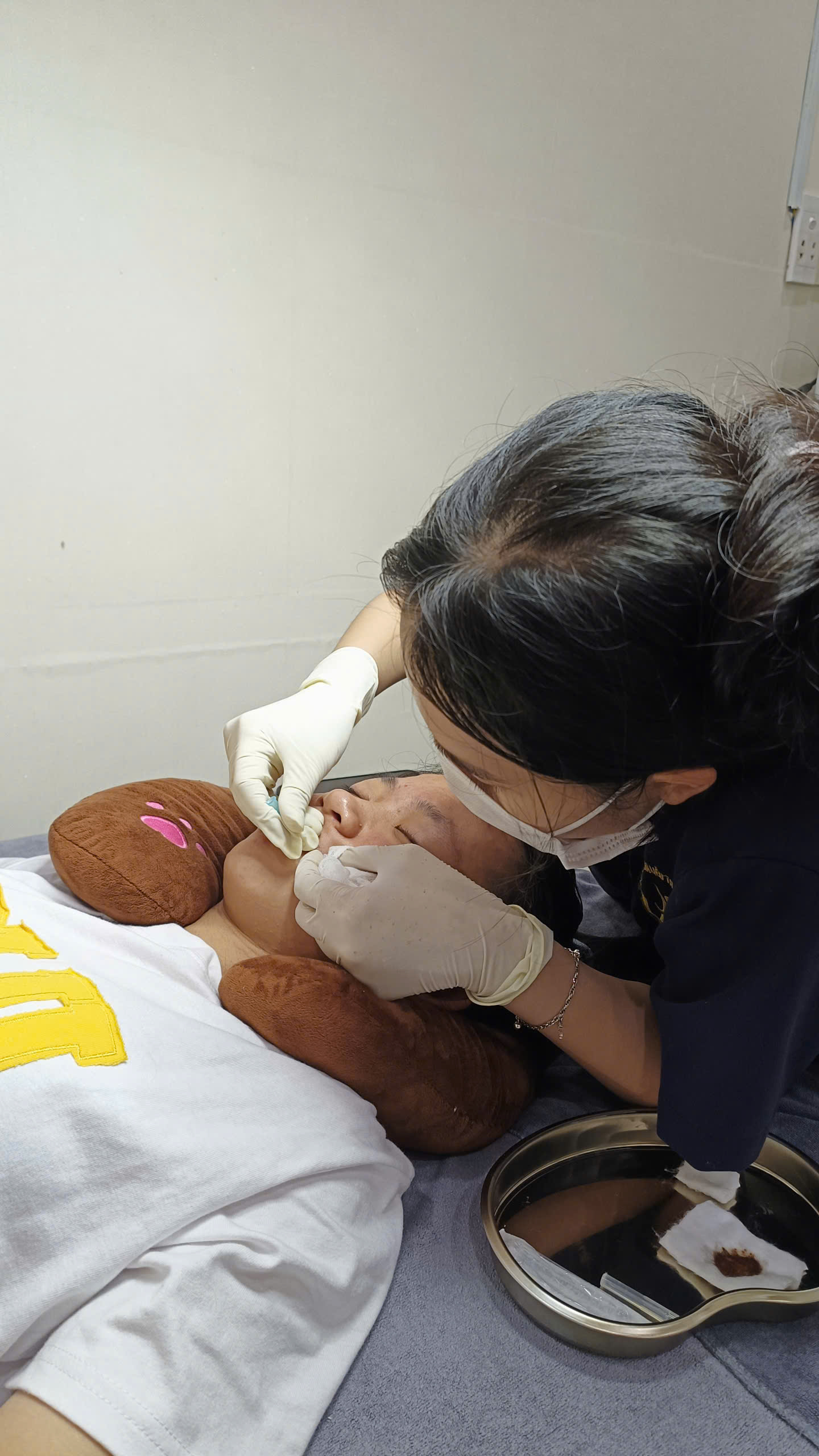 Những điều cần biết về mụn viêm Phòng khám Da liễu Dr Lê Hiệu