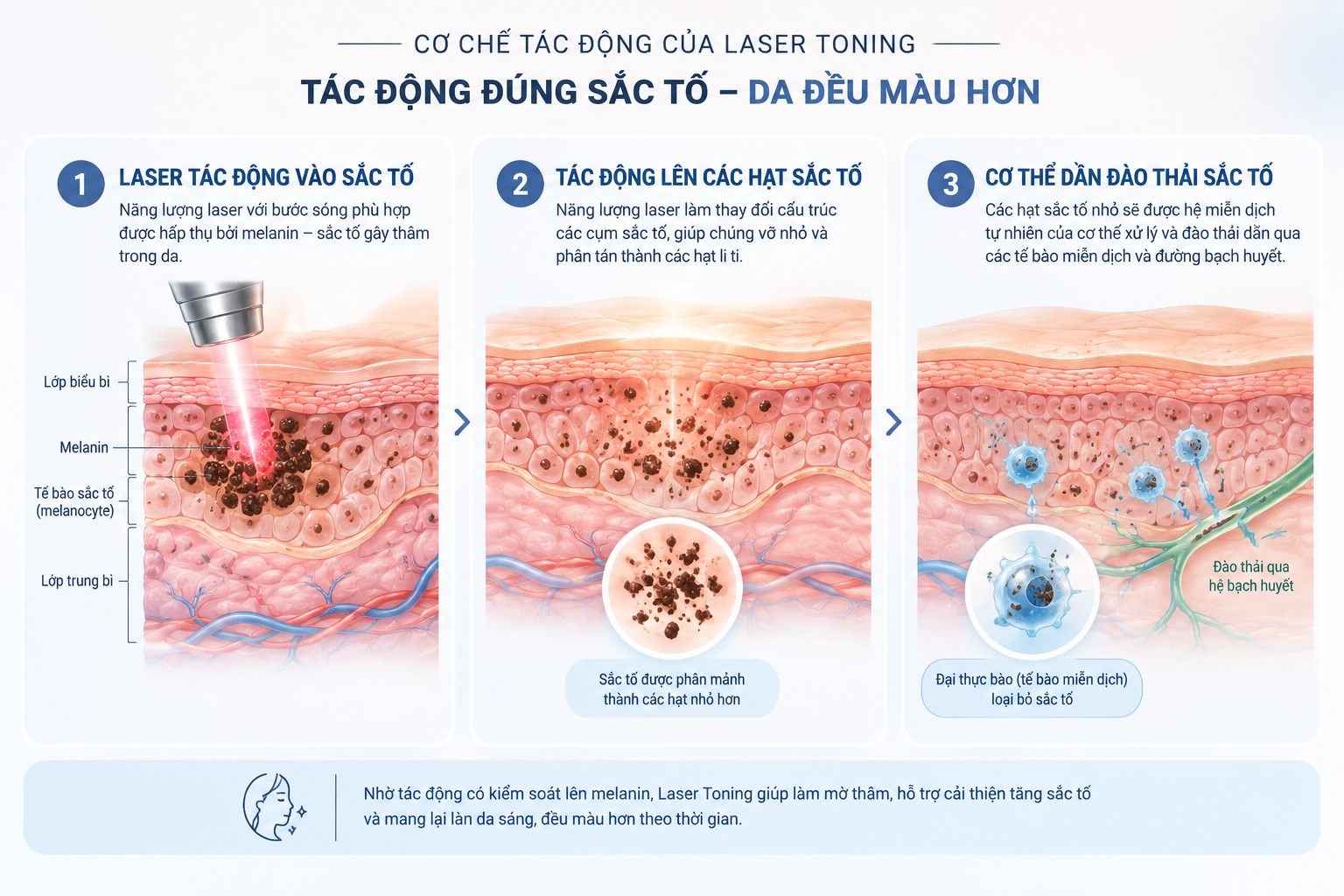 LASER TONING - "CHÌA KHOÁ VÀNG" CẢI THIỆN THÂM MỤN